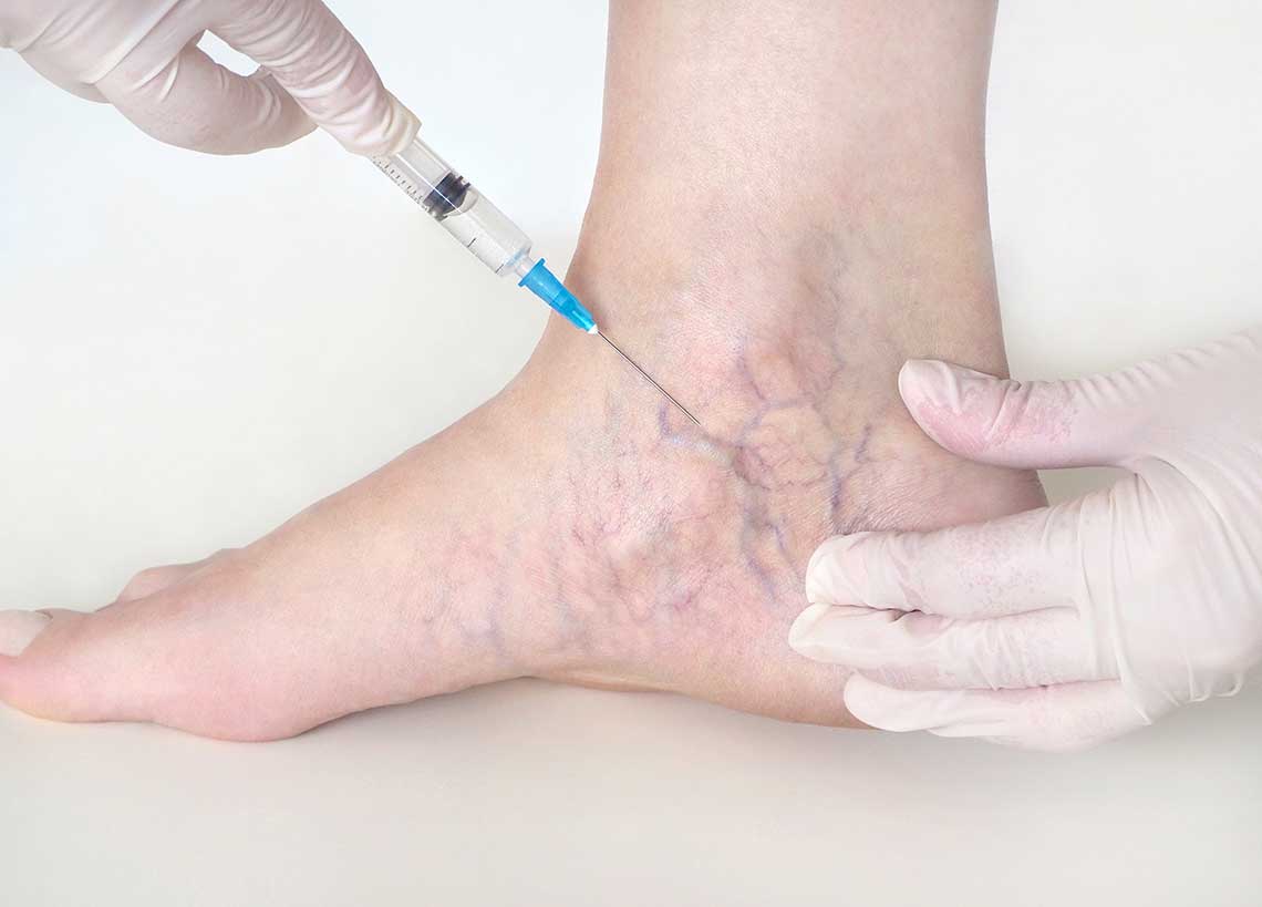What is a Vein Doctor Called