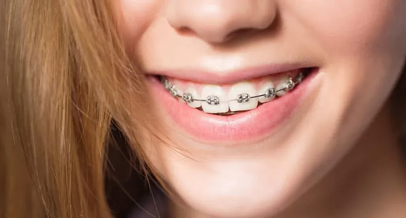 affordable orthodontist