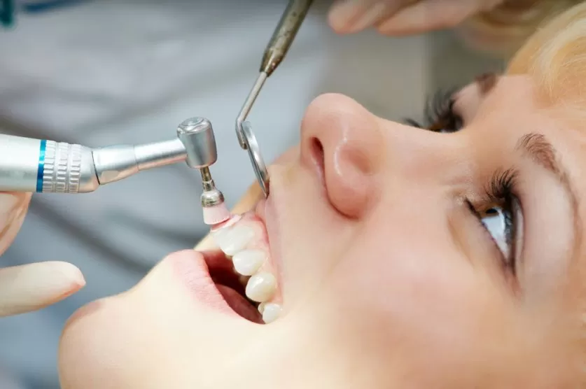 Dental Deep Cleaning