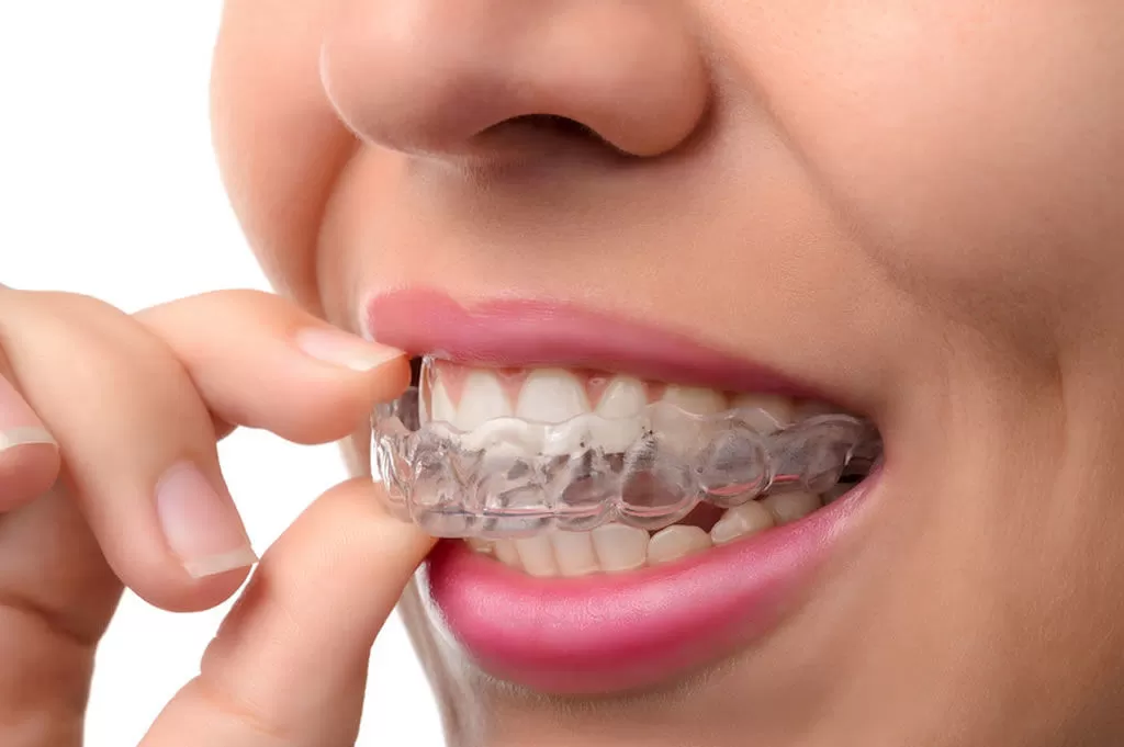 mouth guard for teeth grinding